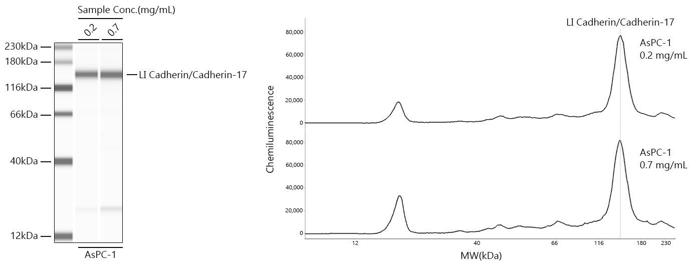 LI Cadherin/Cadherin-17 Rabbit mAb